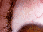 alt "Vein extraction and eye rotation determination"