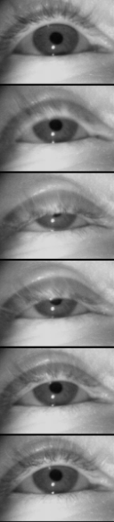 Blink-Detection